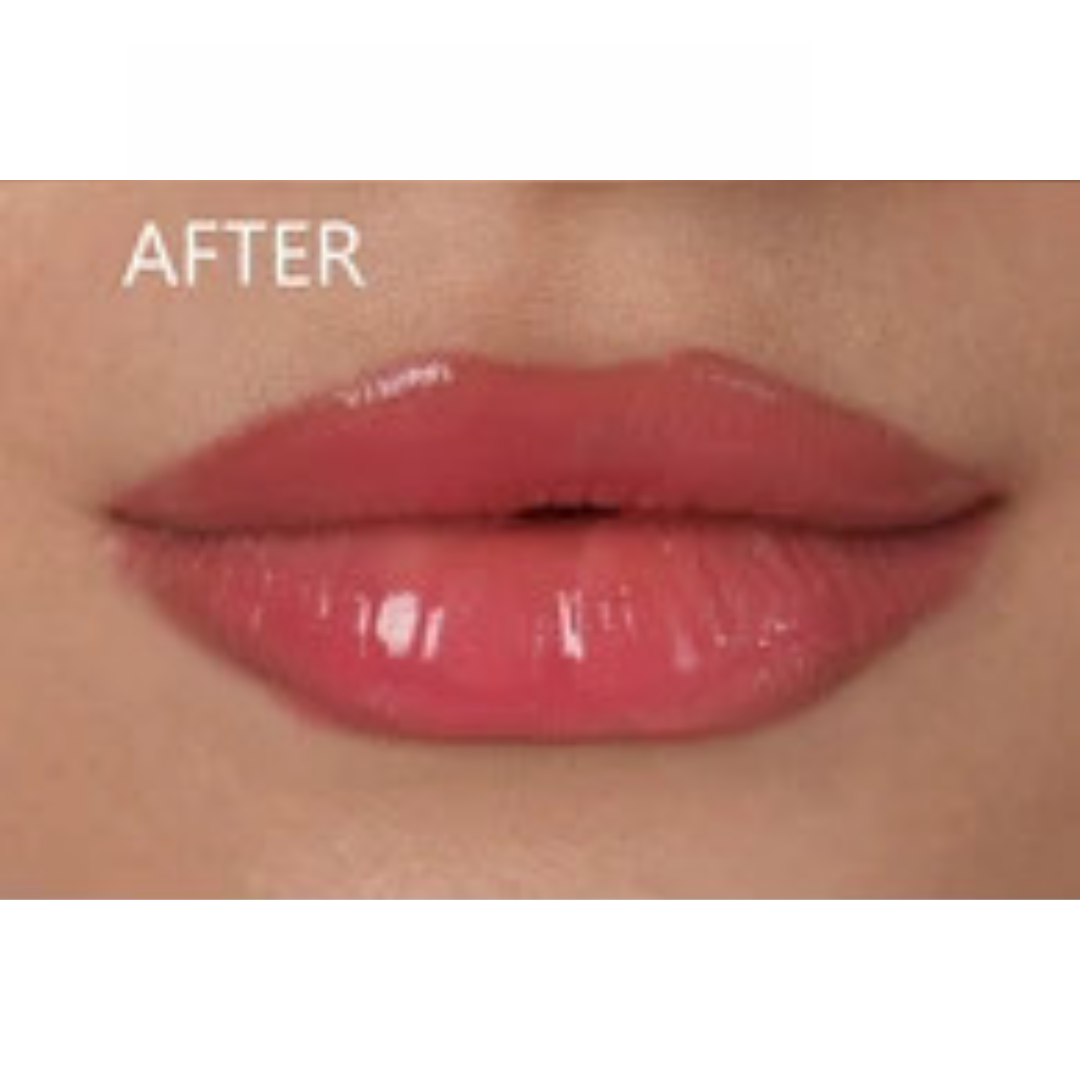 Red Lips after Lip Hyperpigmentation Treatment