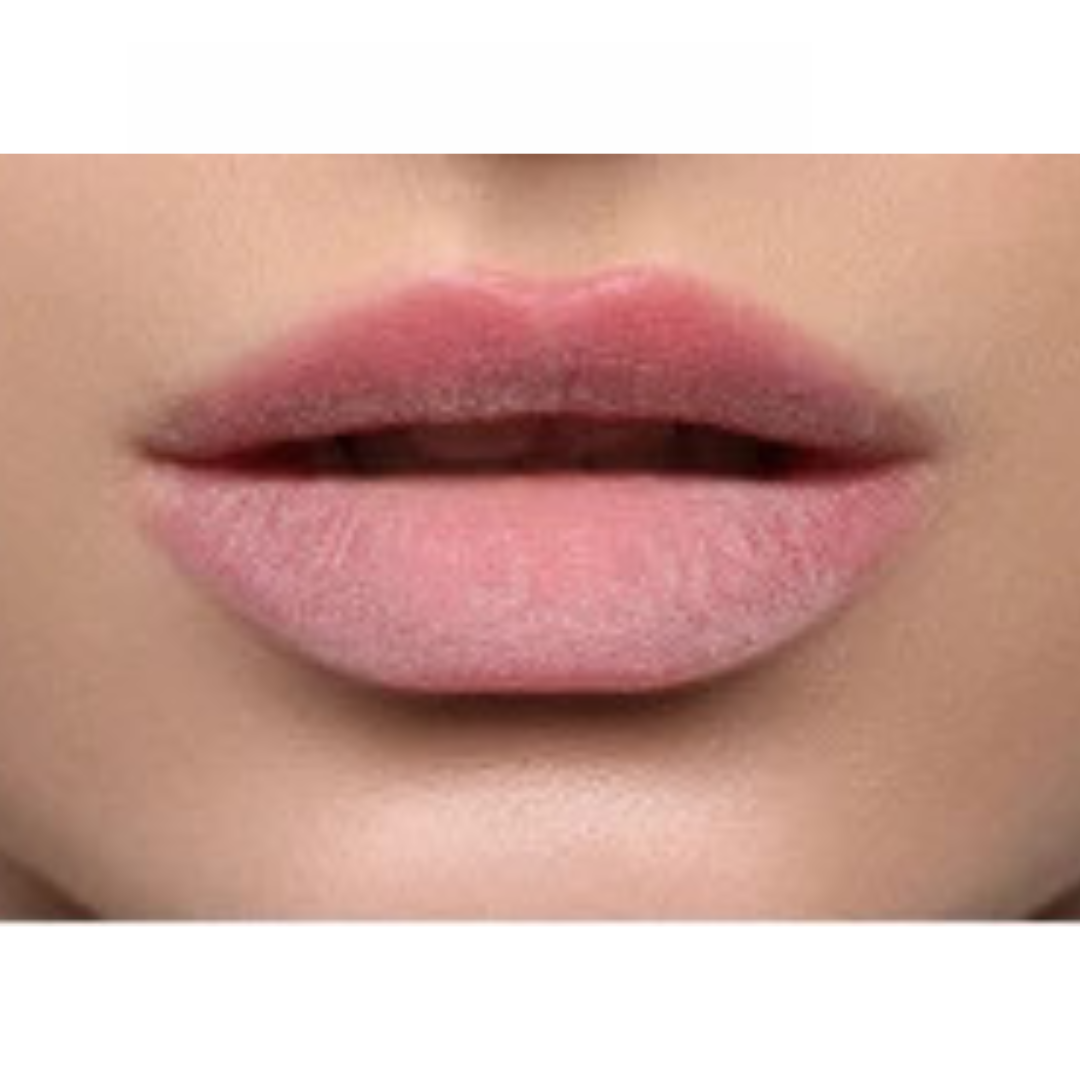 Dark Lips before Lip Hyperpigmentation