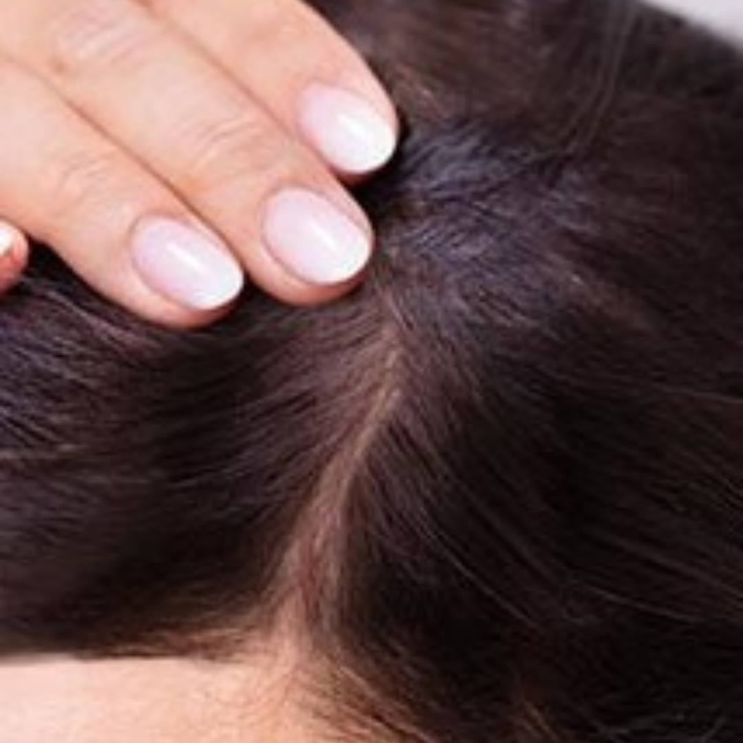 Hairs after mesotherapy Treatment