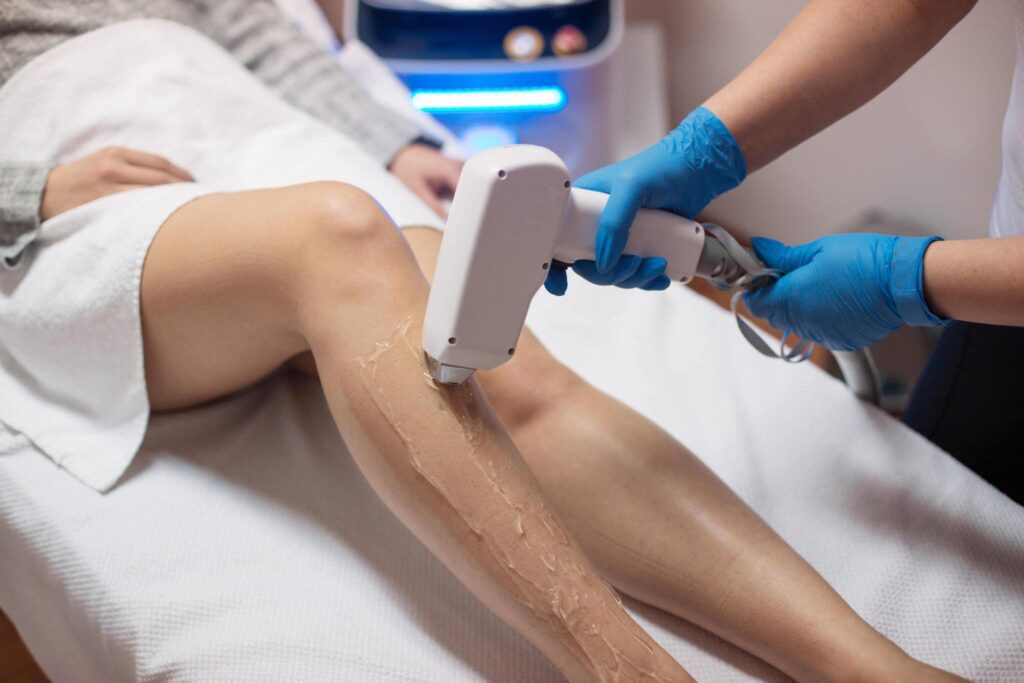 Laser Hair Removal process in Delhi