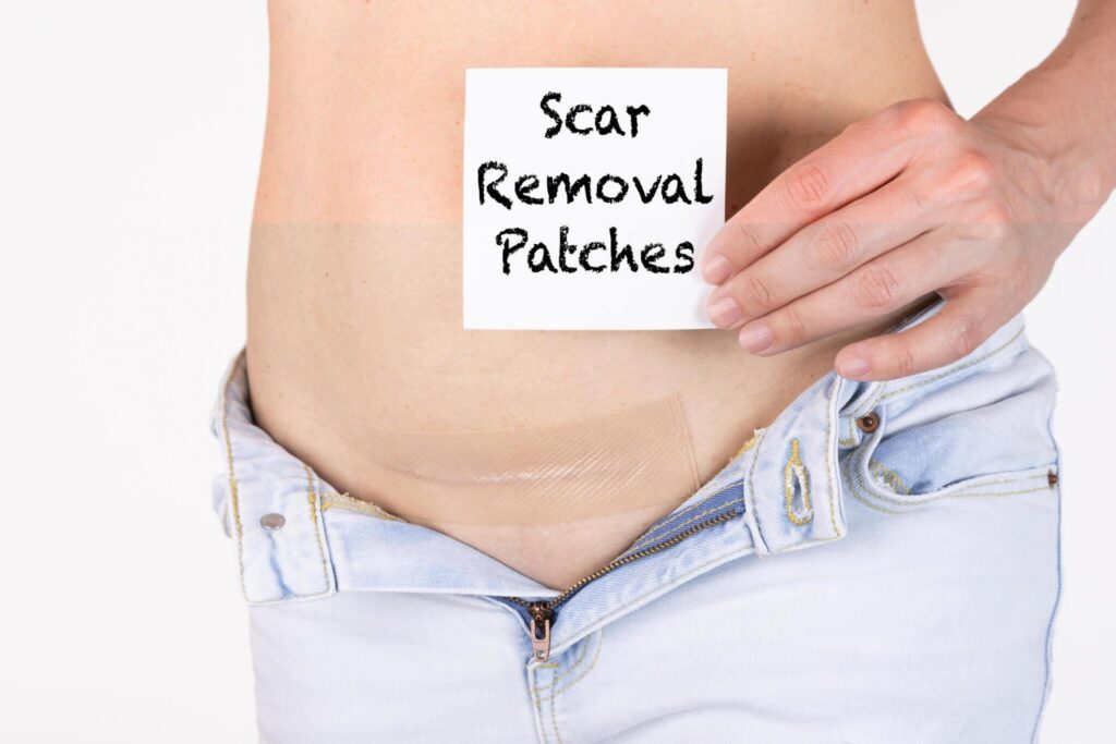 Process of Scar Treatment in Delhi