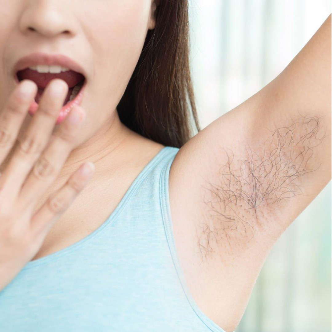 underarms Before Laser hair Removal