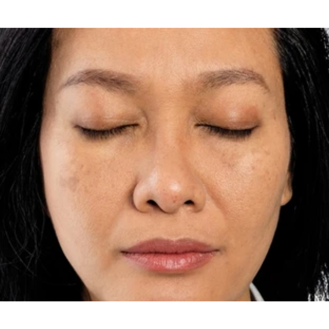 Face Glow before Skin lightening treatment