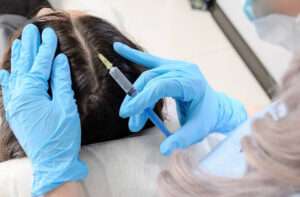 Mesotherapy Hair