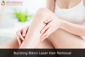 Image for Bursting Bikini Laser Hair Removal