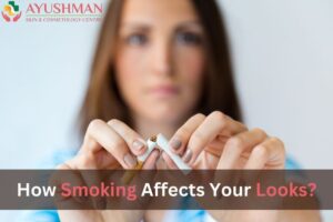 How Smoking Affects Your Looks?