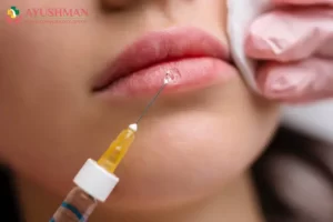 Image for Lip augmentation