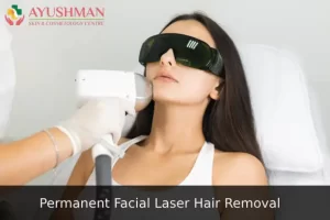 Laser Hair Removal for Facial Skin Woman