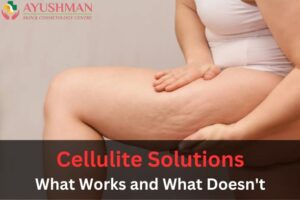 Cellulite Solutions