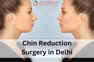 Chin Reduction Surgery in Delhi