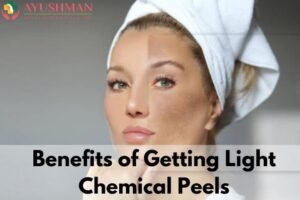 Benefits of Getting Light Chemical Peels