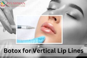 Botox for Vertical Lip Lines