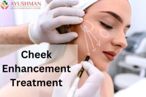 Cheek Enhancement Treatment
