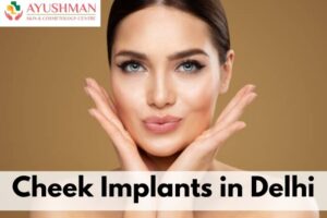 Cheek Implants in Delhi
