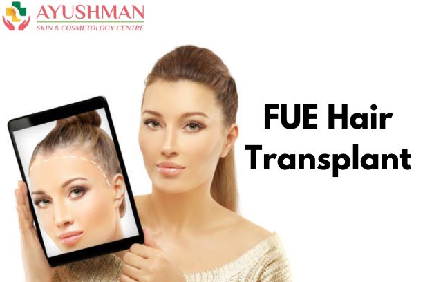 FUE Hair Transplant